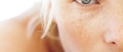 Dyschromia Definition, Symptoms, Causes, Treatment