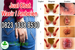 Kapsul-obat-wasir-ambeien-paling-manjur-di-apotik-umum-k24