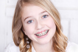 braces treatment in gurgaon