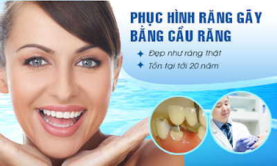 Phương pháp làm cầu răng với cấy ghép Implant có gì khác nhau?