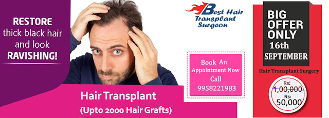 hair transplant surgery in delhi