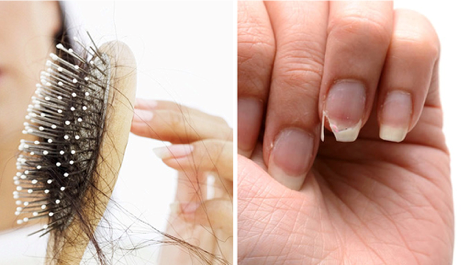 Here's How To Stop Hair Loss And Brittle Nails With My Grandmother's Tip