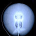 LOL- XRAY OF STINGRAY