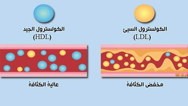 تعريف الكوليسترول السيئ والجيد