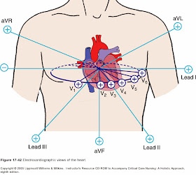 Interpretasi EKG
