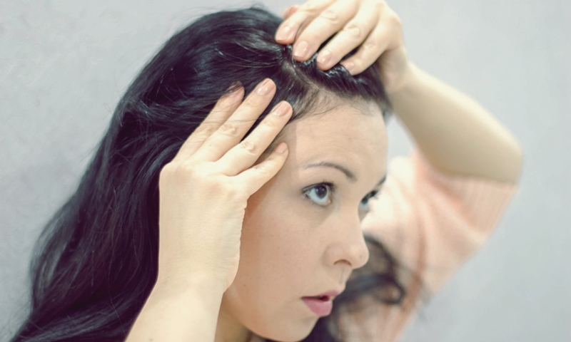 Genç yaştaki saç kayıpları engellenebilir mi?