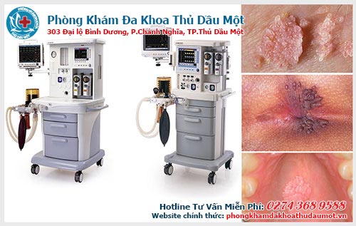 Kỹ thuật PDT - Chữa sùi mồng gà hiệu quả