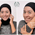 Cara Menghilangkan Belang Di Wajah Karena Hijab