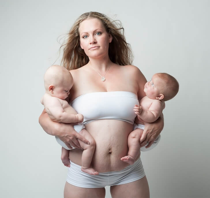 A Photographer Shows How Female Bodies Truly Look Like After Pregnancy