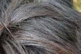 premature greying. grey  hair