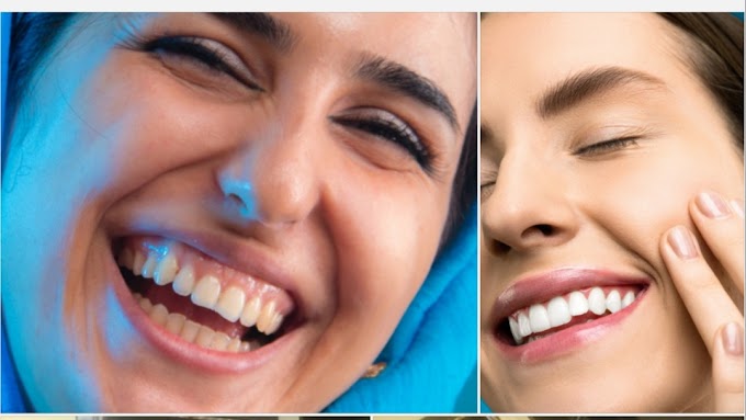 5 benefits of pure natural Udeem tooth Powder ।। शुद्ध प्राकृतिक दंत मंजन के 5 फायदे