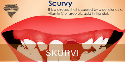 Tanda-tanda Kekurangan Vitamin C