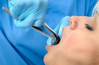Highland Park Surgeon Dental Implants Proper Care