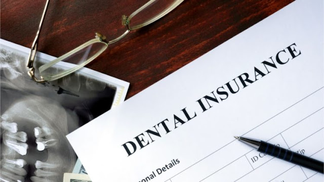 5 Reasons You Need Dental Insurance Plan