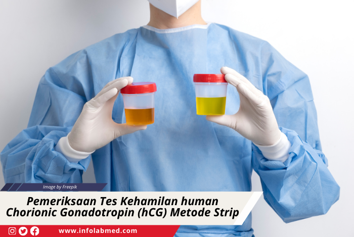 Pemeriksaan Tes Kehamilan human Chorionic Gonadotropin (hCG) Metode Strip