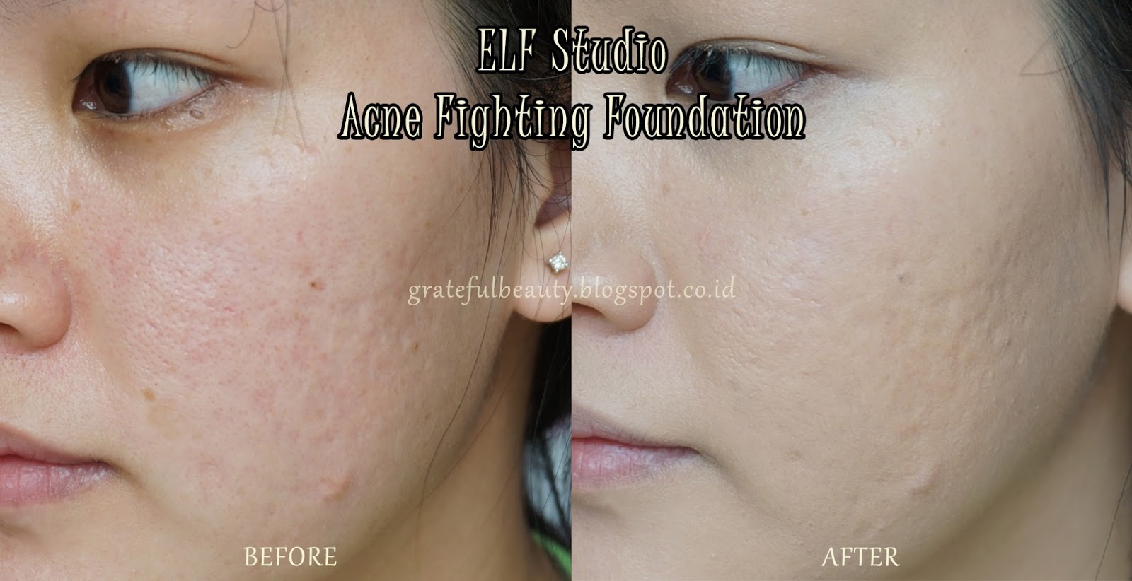 REVIEW ELF Acne Fighting Foundation Tampil Cantik