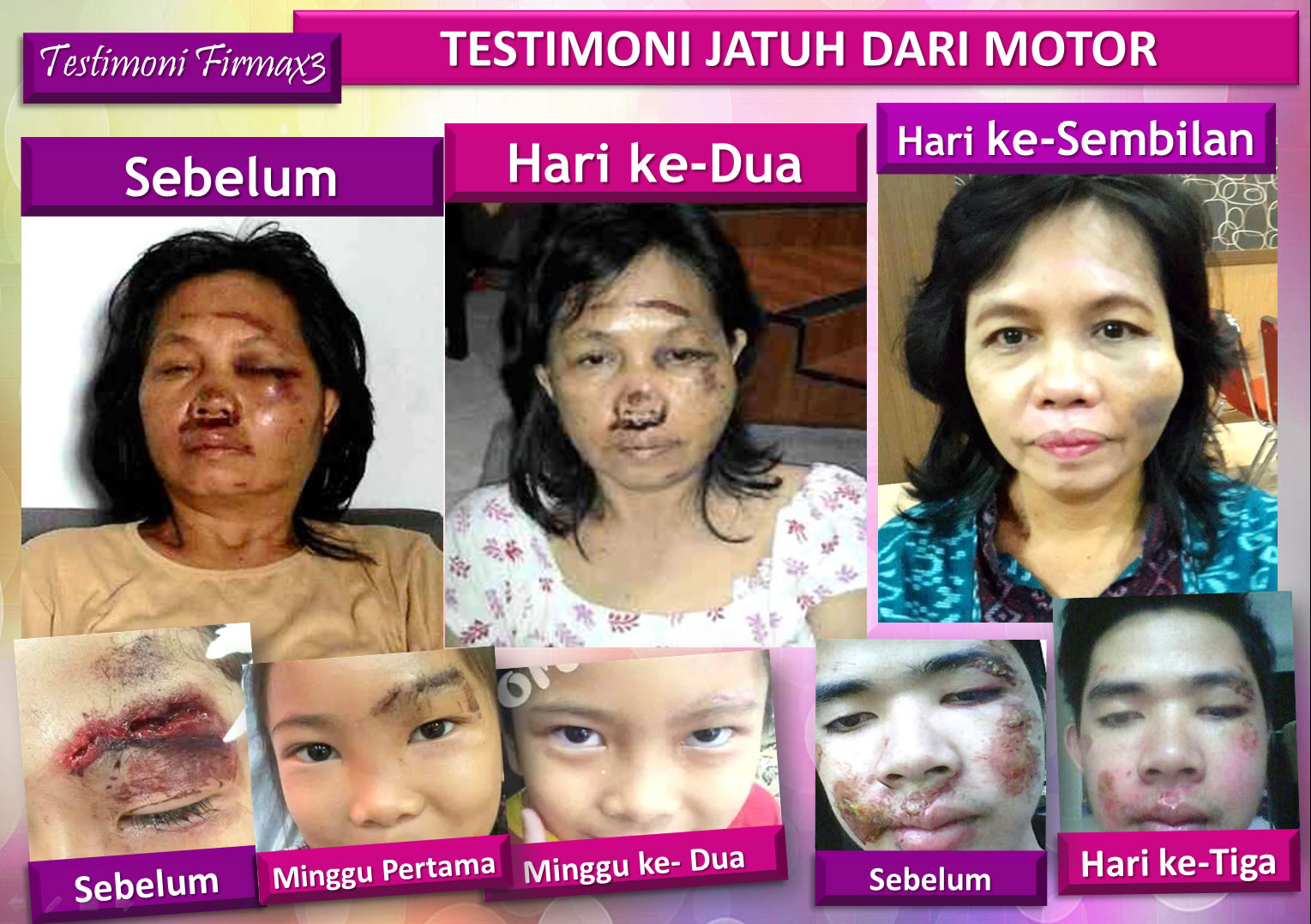 Testimoni Firmax3 Cream Indonesia