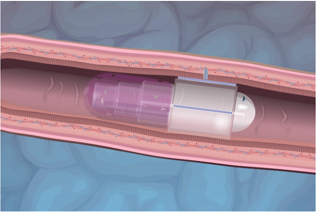 Rani Therapeutics-Robotic Pill to Replace Injectable Biologic