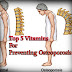 Top 5 Vitamins For Preventing Osteoporosis