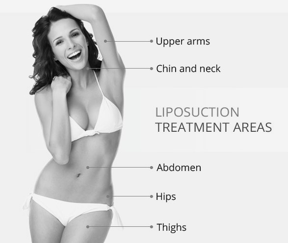 liposuction singapore