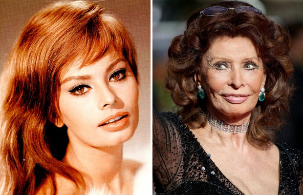 Sophia Loren Plastic Surgery Before And After Photo