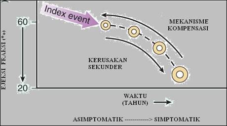 Patofisiologi Gagal Jantung