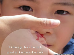 Punca Hidung Anak Berdarah, Jangan Pandang Ringan Jika Berlaku Pendarahan