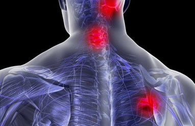 Dolor de cuello y hombros Pilates Aldapas-Algorta