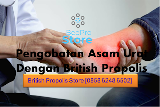 Pengobatan Asam Urat Dengan British Propolis - British Propolis Store [0858 6248 6502]