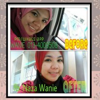 Nour Ain Beauty Care ( Wanie ): Testimoni Pengguna Nour ...