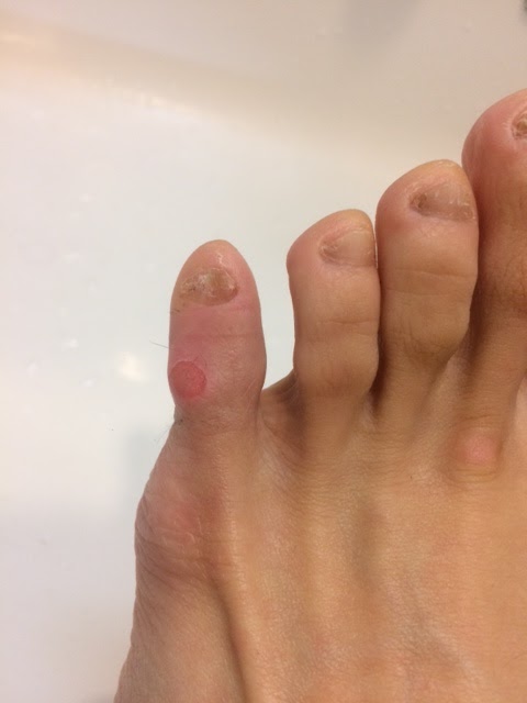 踊る猫爆弾 皮 剥けた 踊る猫爆弾 皮 剥けた