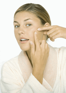 Tips to remove pimples