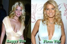 Jessica Simpson Plastic Surgery Before And After