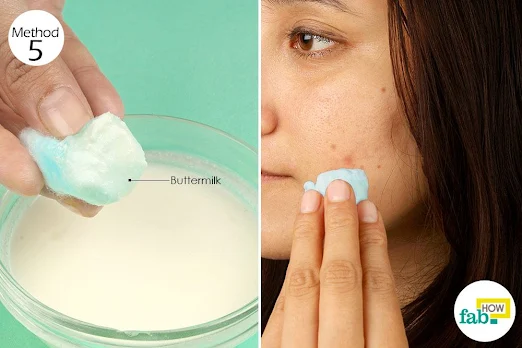 Natural Remedies To Get Rid of Dark Spots: buttermilk