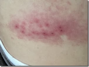 photo-6