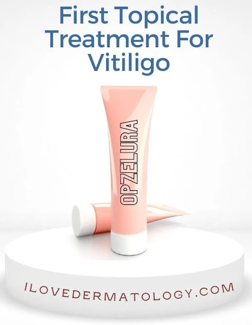 nonsegmental vitiligo, crema opzelura, opzelura crema para que sirve, segmental vitiligo