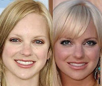 Celebrities Before And After Plastic Surgery