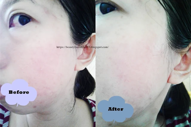 Dr. Morita Hyaluronic Acid Essence Mask