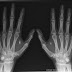 RFID microchip implants on humans will jeopardize their security