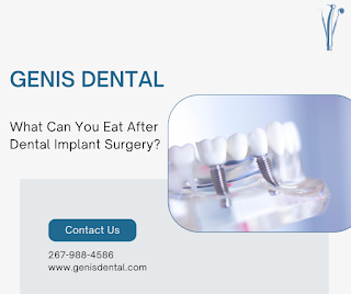 What To Eat After Dental Implant Surgery?