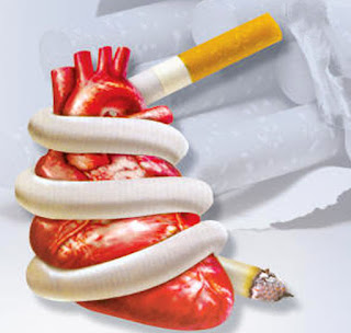 Factors that coronary heart disease