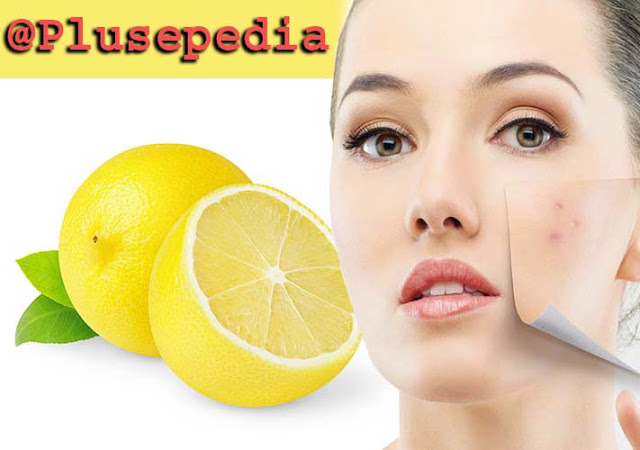 Acne-treatment-with-lemon