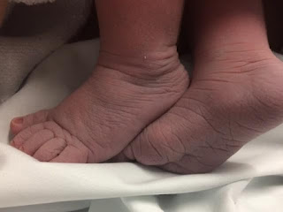 baby feet