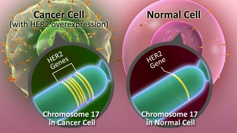 HER2-Positive Breast Cancer