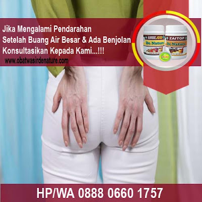 Obat Tradisional Wasir Parah