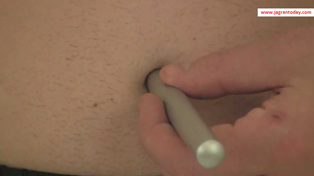 Permanent Solution for Navel Displacement