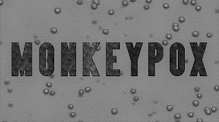 Monkeypox Disease: Causes, Symptoms