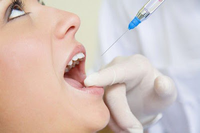 Nhổ răng hàm không đau như thế nào?