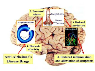 gejala dan penyebab penyakit alzheimer