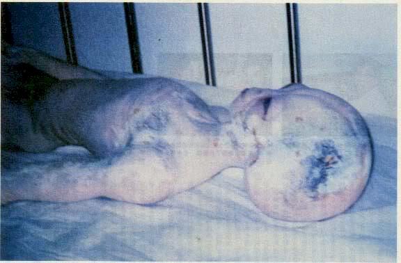 Alien Body Real